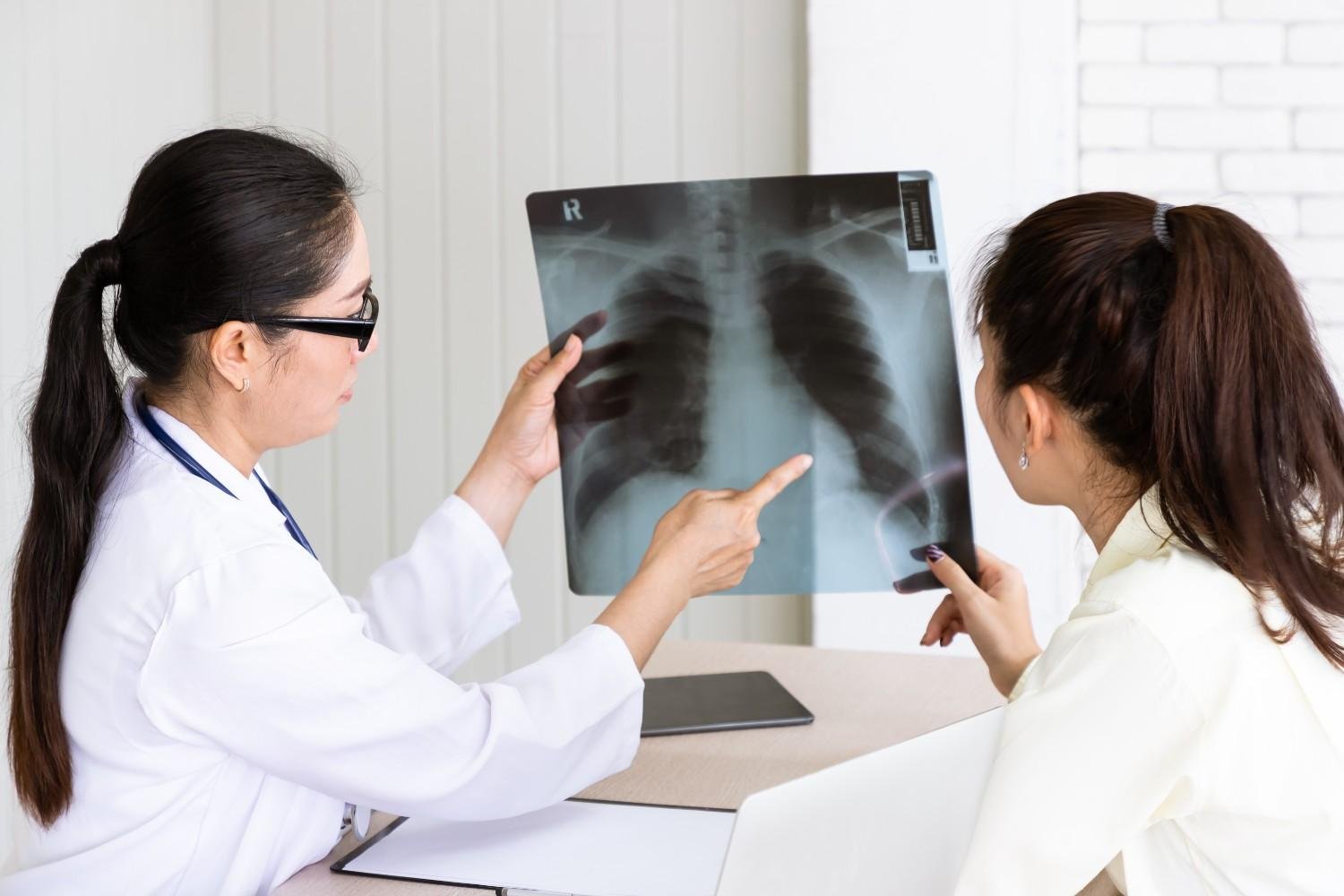 Best Tuberculosis Treatment in Rajouri Garden