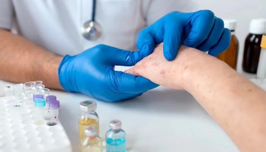 Best Allergy Clinic in Dwarka