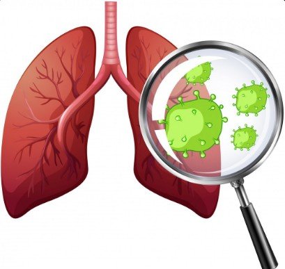 Tuberculosis Treatment in Vikaspuri