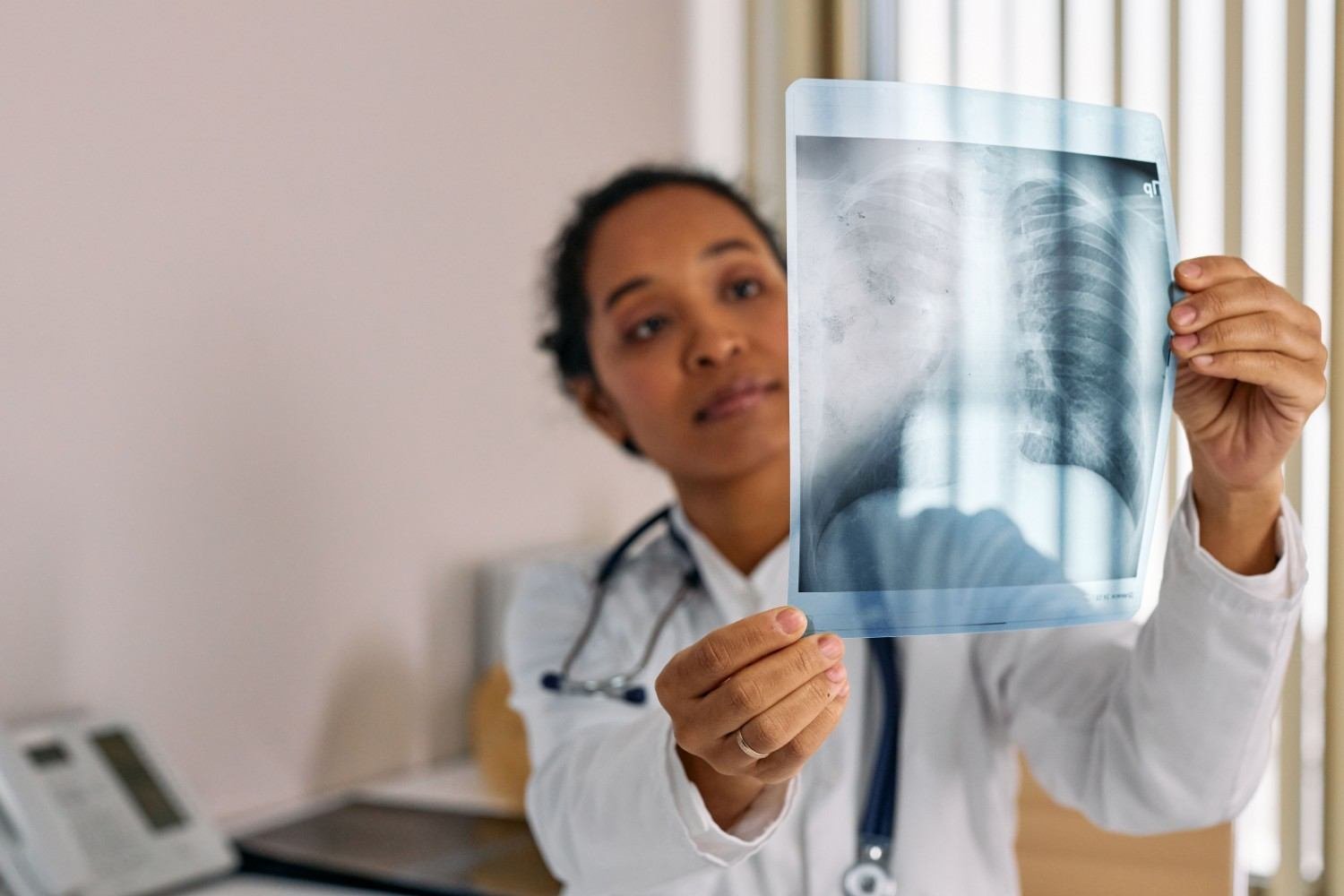 Lung Cancer Specialist in Vikaspuri